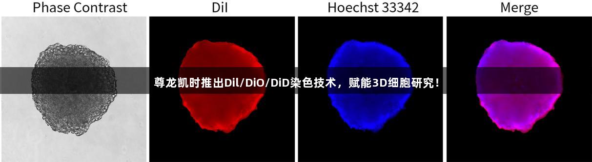 尊龙凯时推出Dil/DiO/DiD染色技术，赋能3D细胞研究！