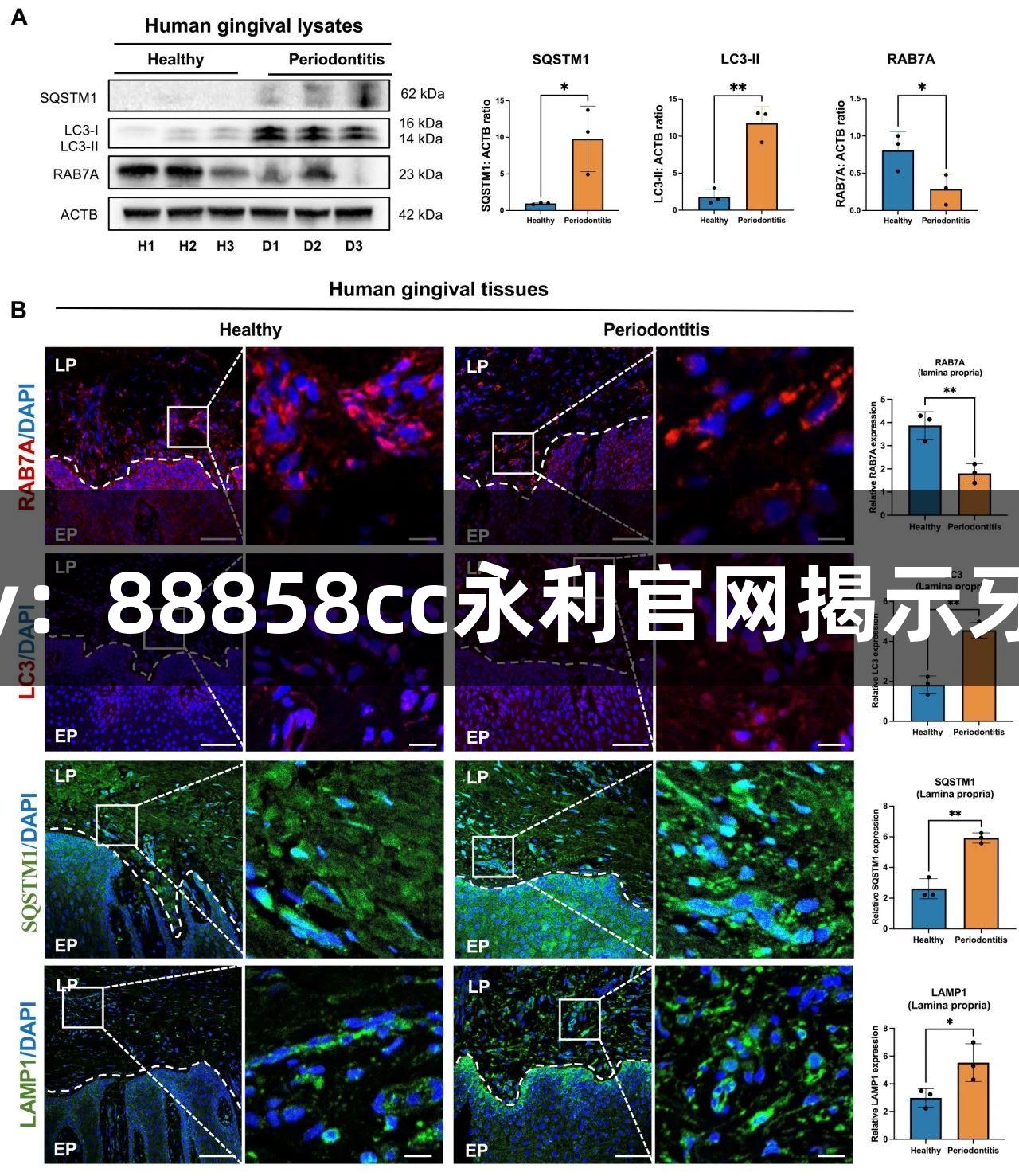 Autophagy：88858cc永利官网揭示牙周炎新机制