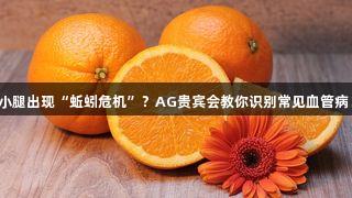 小腿出现“蚯蚓危机”？AG贵宾会教你识别常见血管病！