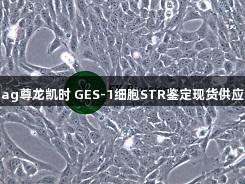 ag尊龙凯时 GES-1细胞STR鉴定现货供应
