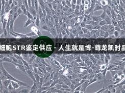 GES-1细胞STR鉴定供应 - 人生就是博-尊龙凯时品牌推荐