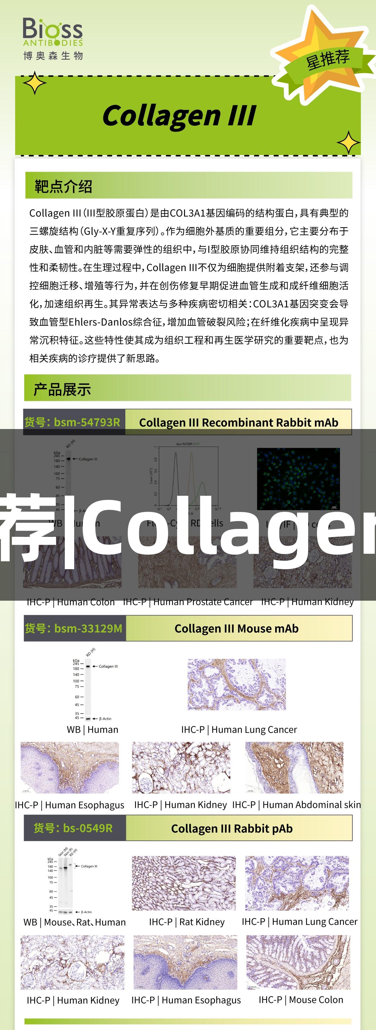 尊龙凯时推荐|CollagenIII抗体介绍