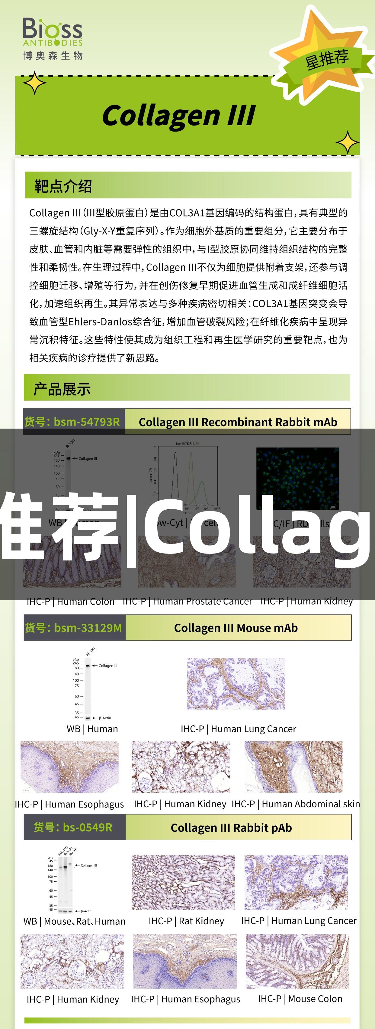 尊龙凯时推荐|Collagen III抗体
