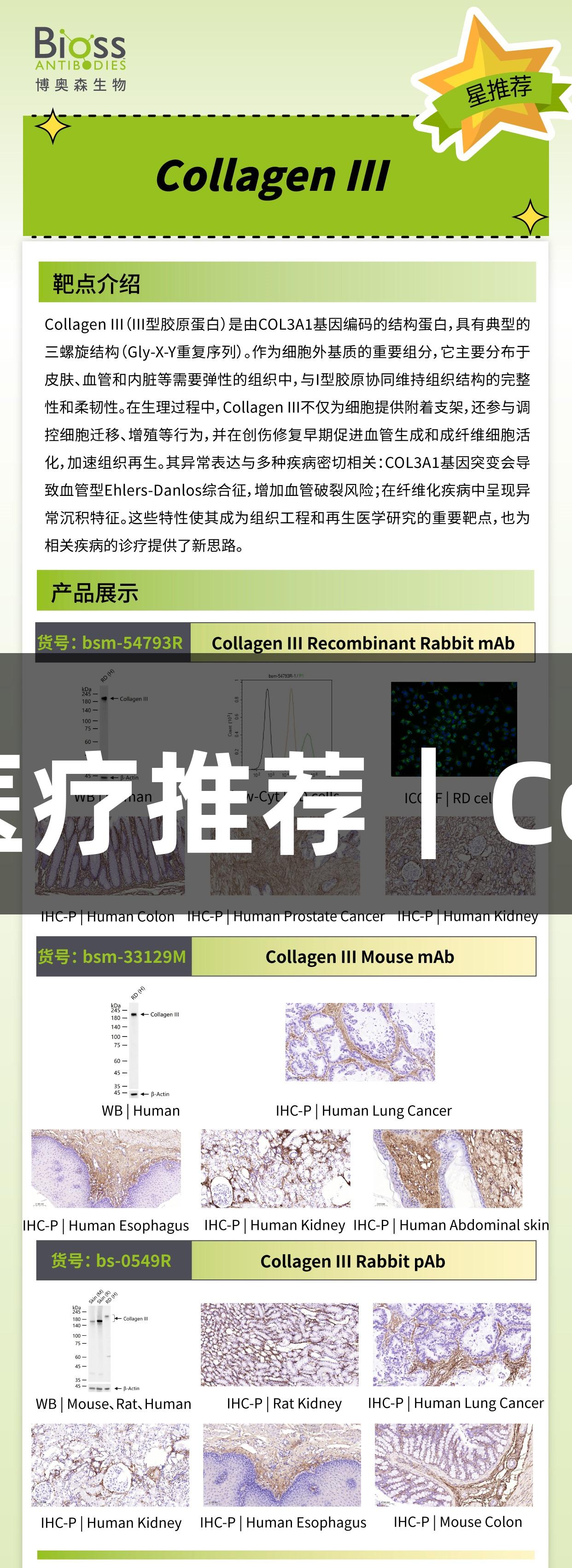 尊龙凯时生物医疗推荐｜Collagen III抗体