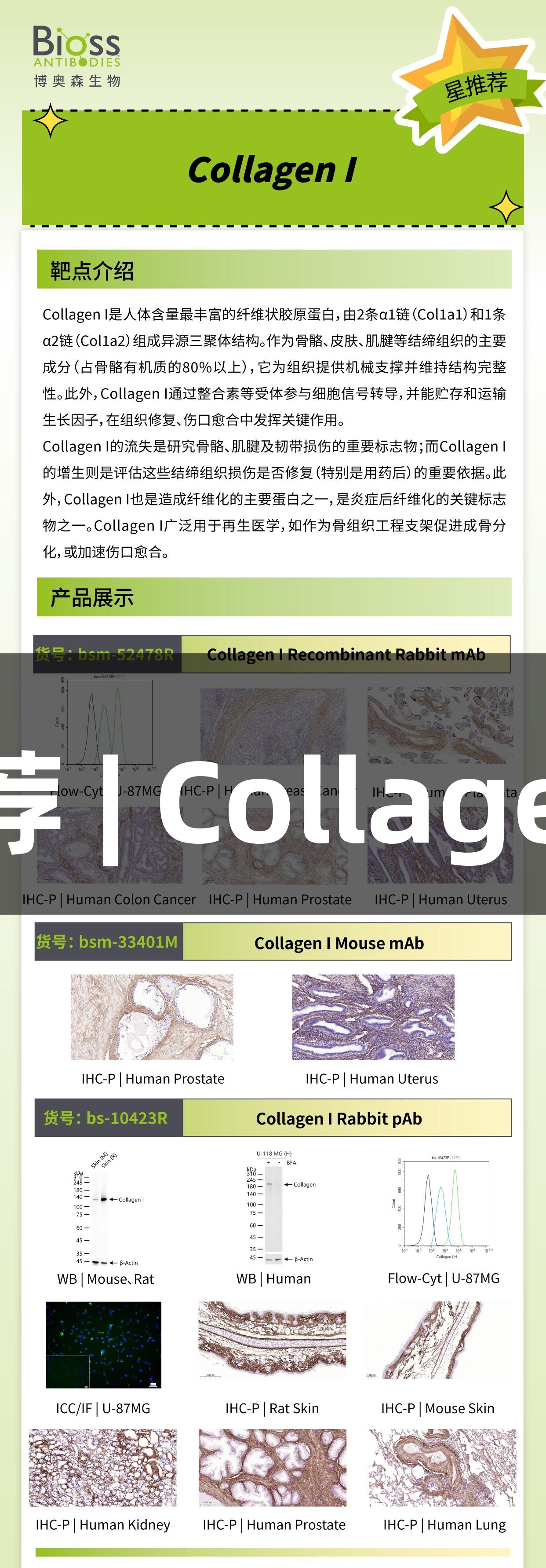 尊龙凯时推荐 | Collagen I抗体解析