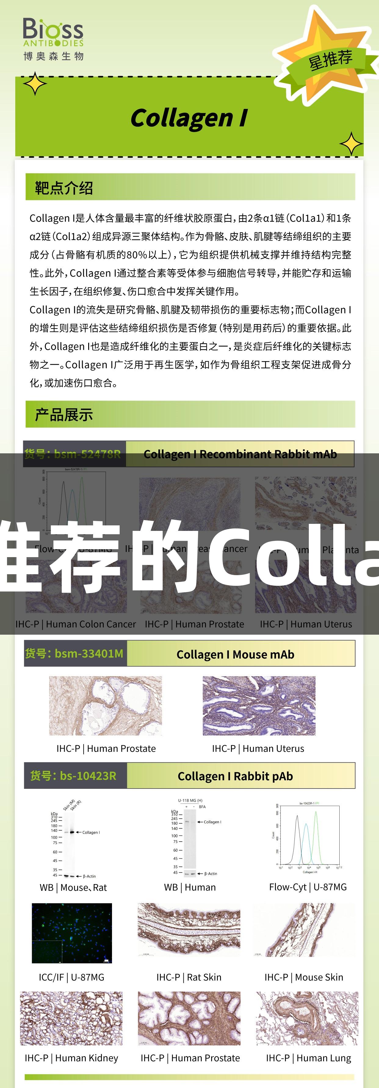 尊龙凯时推荐的CollagenI抗体
