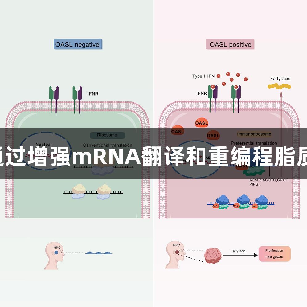 尊龙凯时：OASL通过增强mRNA翻译和重编程脂质代谢推动癌症进展