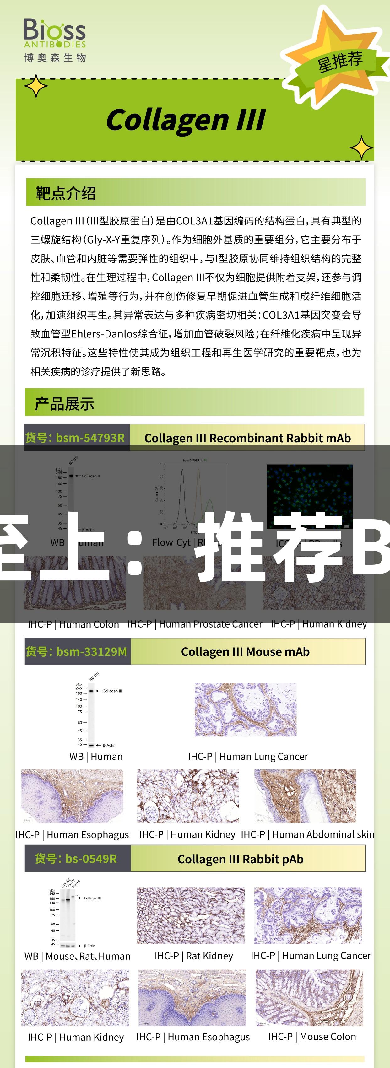金年会金字招牌诚信至上：推荐Bioss CollagenIII抗体
