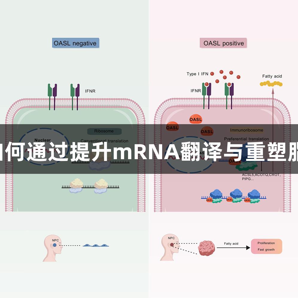 尊龙凯时解析OASL如何通过提升mRNA翻译与重塑脂质代谢推动癌症发展