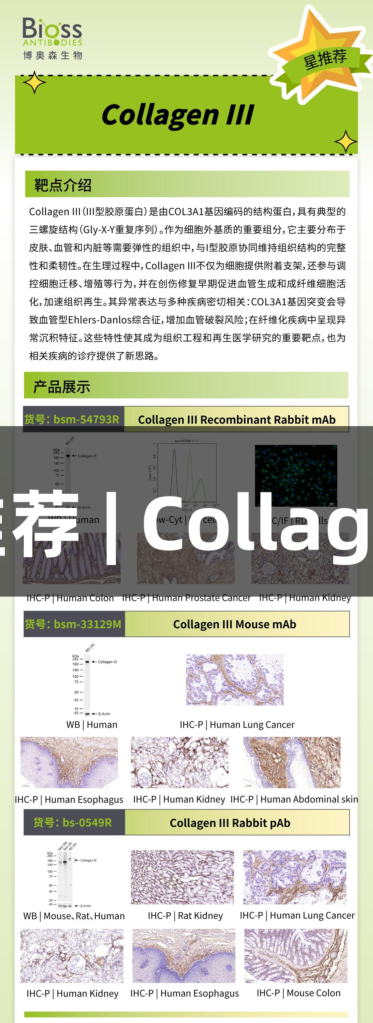 南宫28推荐 | CollagenIII抗体