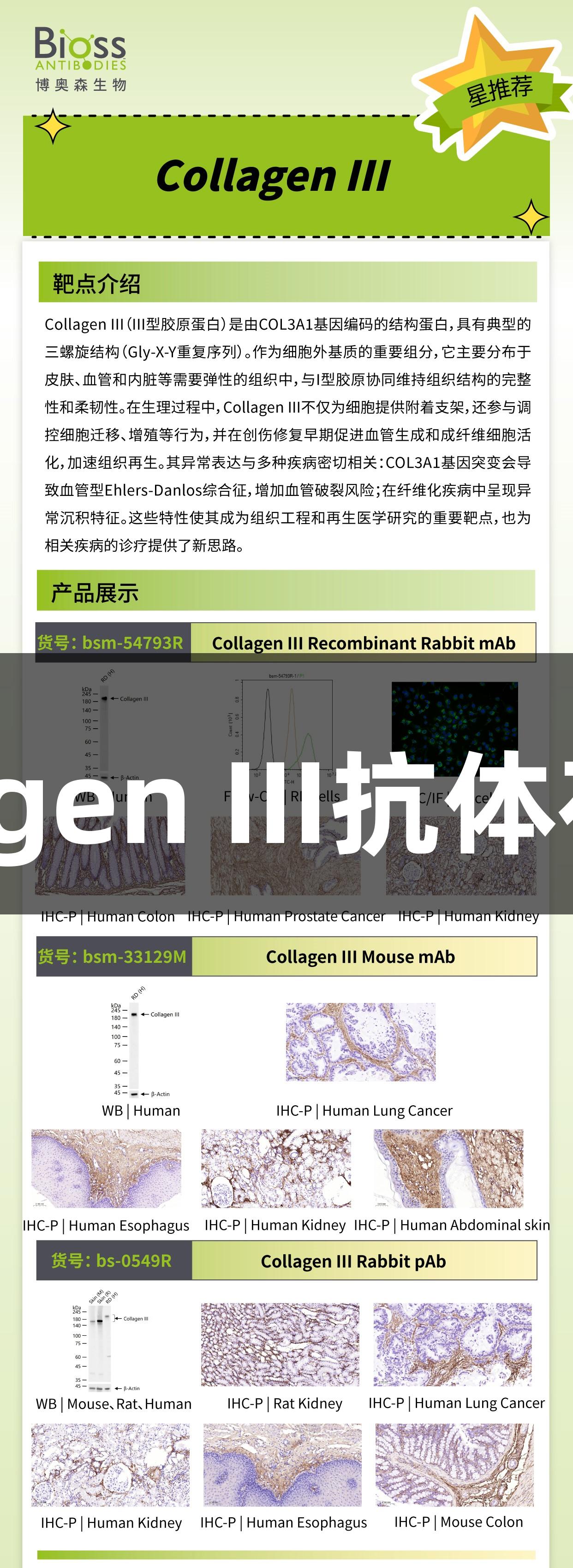 尊龙凯时推荐的Collagen III抗体在生物医疗领域的应用