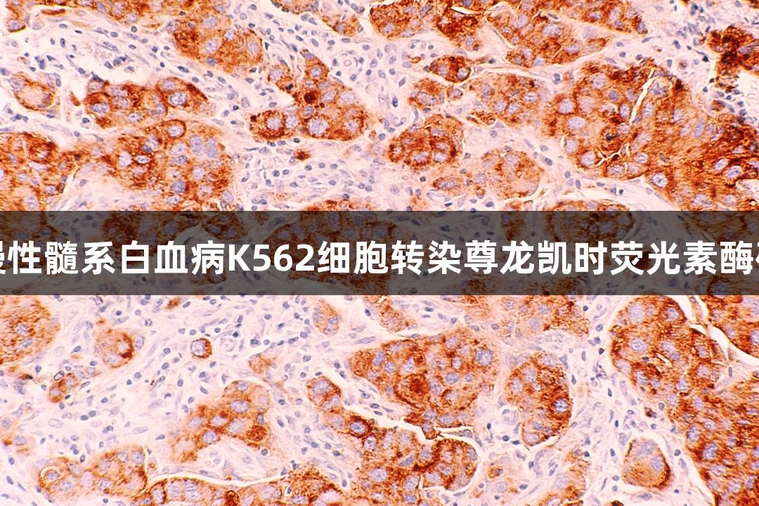 人慢性髓系白血病K562细胞转染尊龙凯时荧光素酶研究
