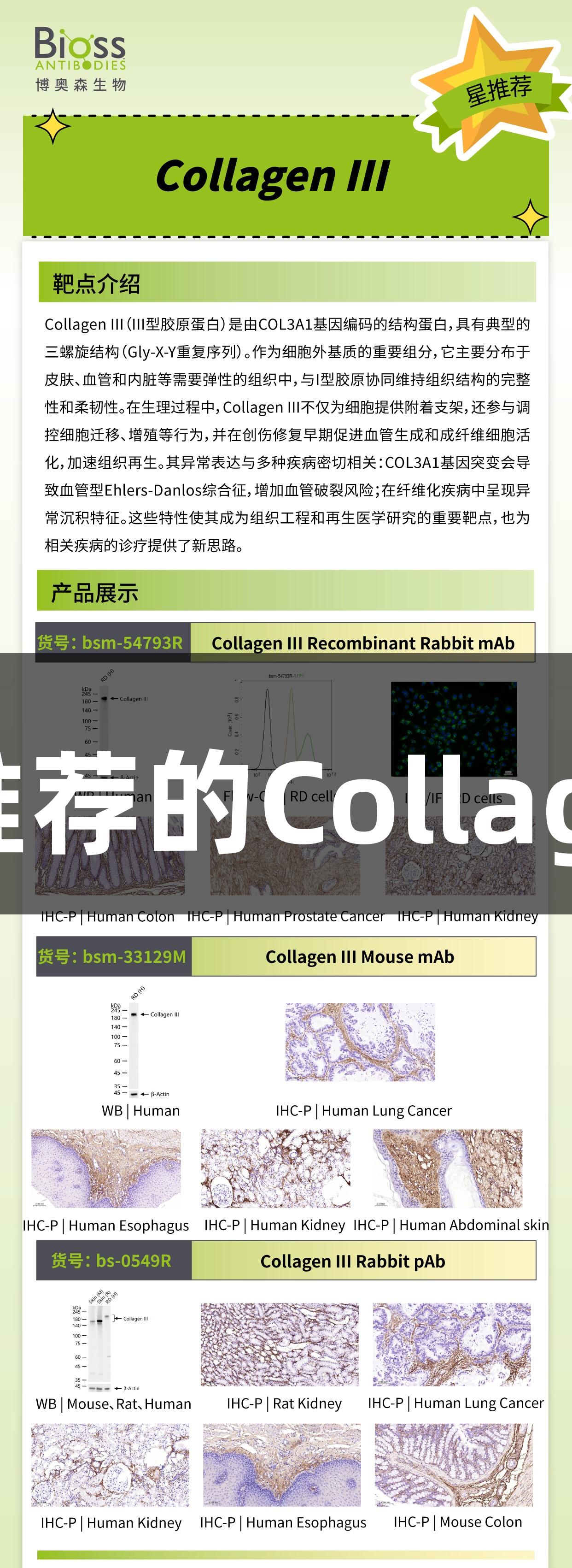 尊龙凯时推荐的Collagen III抗体