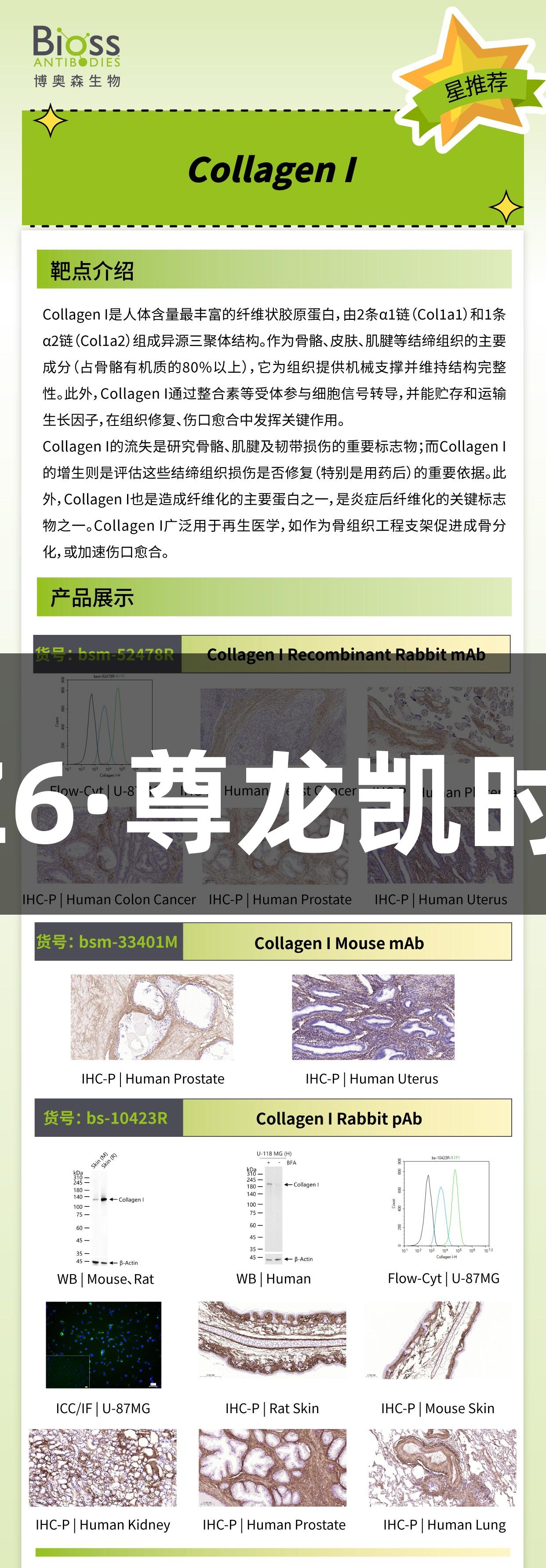 Bioss星推荐的Z6·尊龙凯时 CollagenI抗体