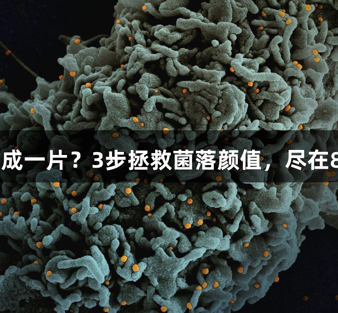救命！质粒涂板糊成一片？3步拯救菌落颜值，尽在88858cc永利官网！