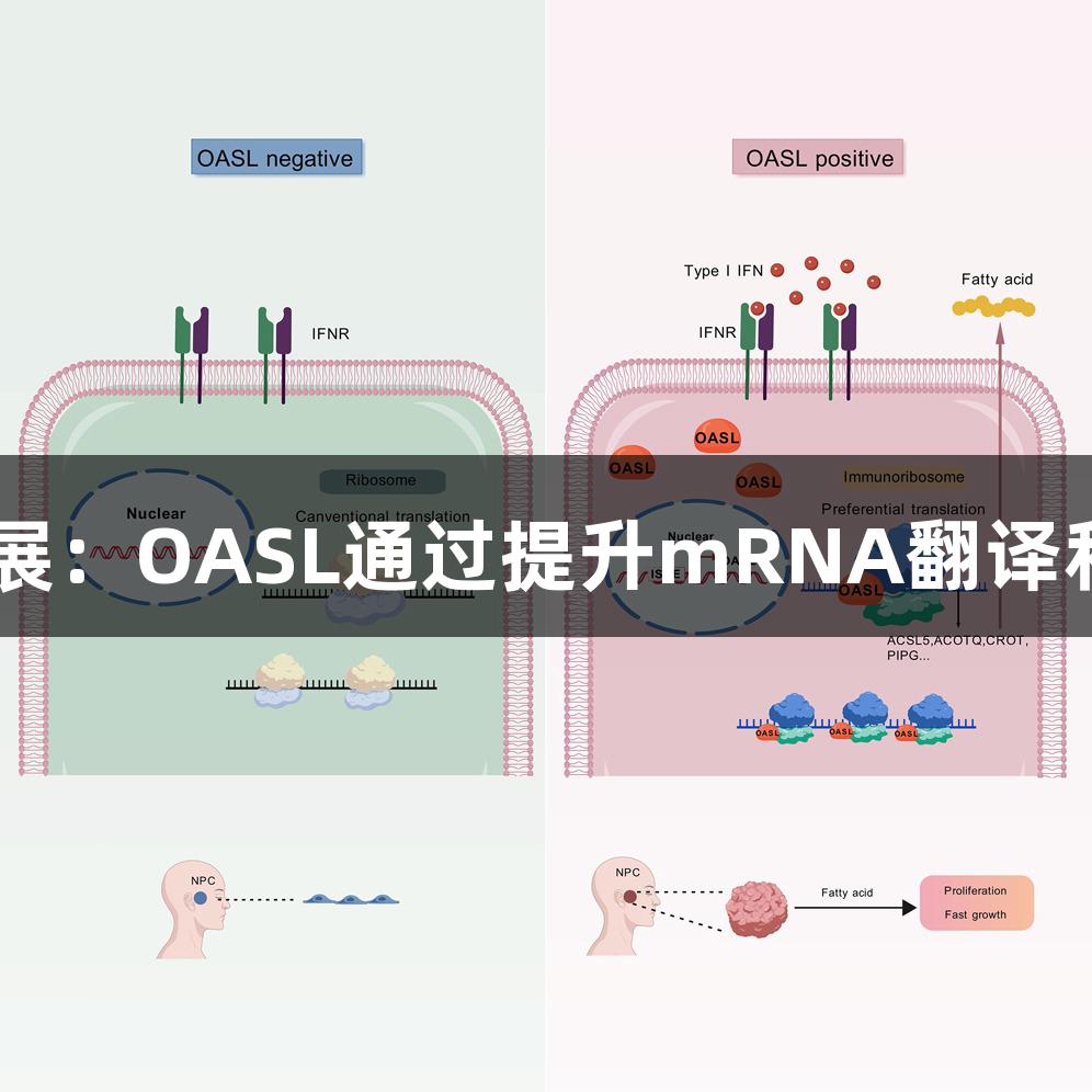 南宫28促癌症进展：OASL通过提升mRNA翻译和脂质代谢重编程