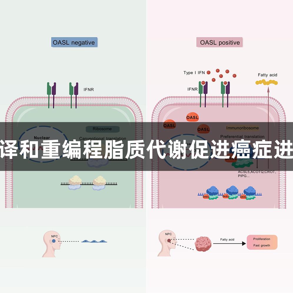 OASL通过增强mRNA翻译和重编程脂质代谢促进癌症进展-人生就是博-尊龙凯时