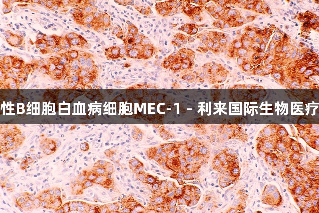 人慢性B细胞白血病细胞MEC-1 - 利来国际生物医疗研究