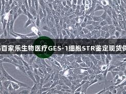AG百家乐生物医疗GES-1细胞STR鉴定现货供应