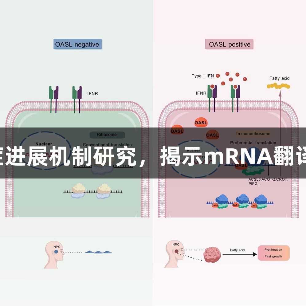 尊龙凯时：OASL促进癌症进展机制研究，揭示mRNA翻译与脂质代谢重编程的关联