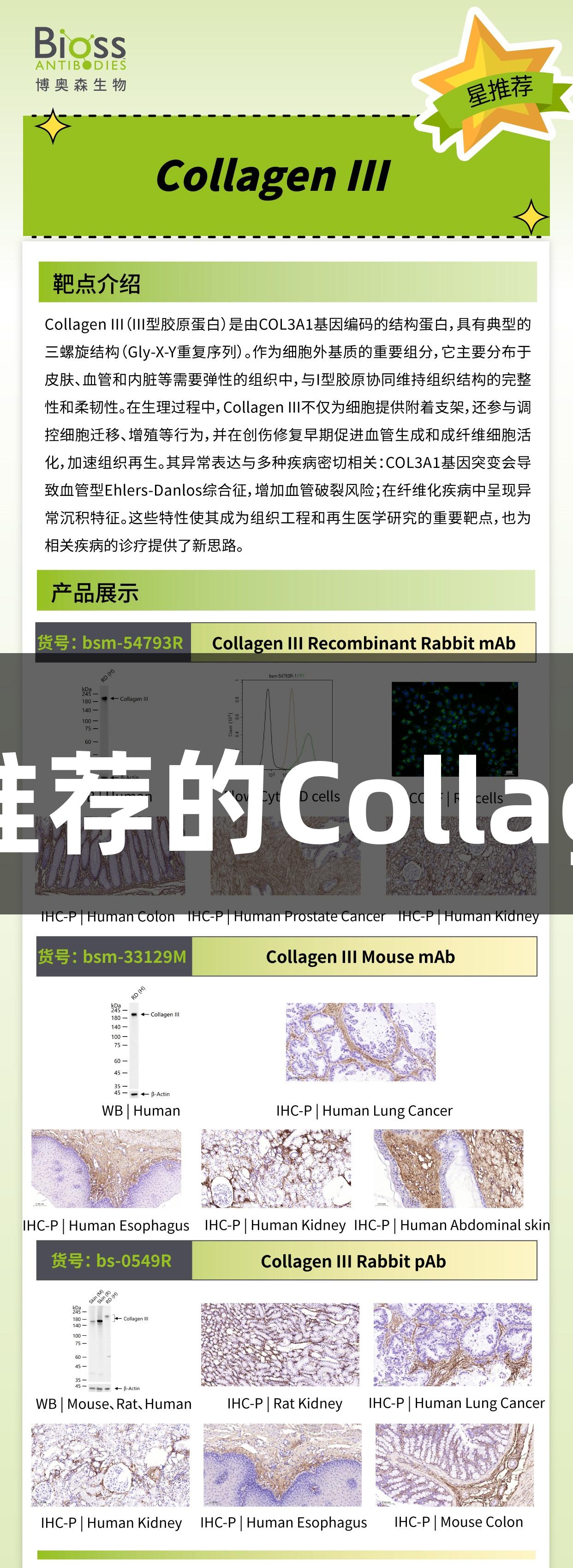 尊龙凯时推荐的CollagenIII抗体