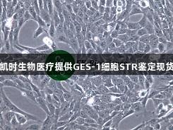 尊龙凯时生物医疗提供GES-1细胞STR鉴定现货供应