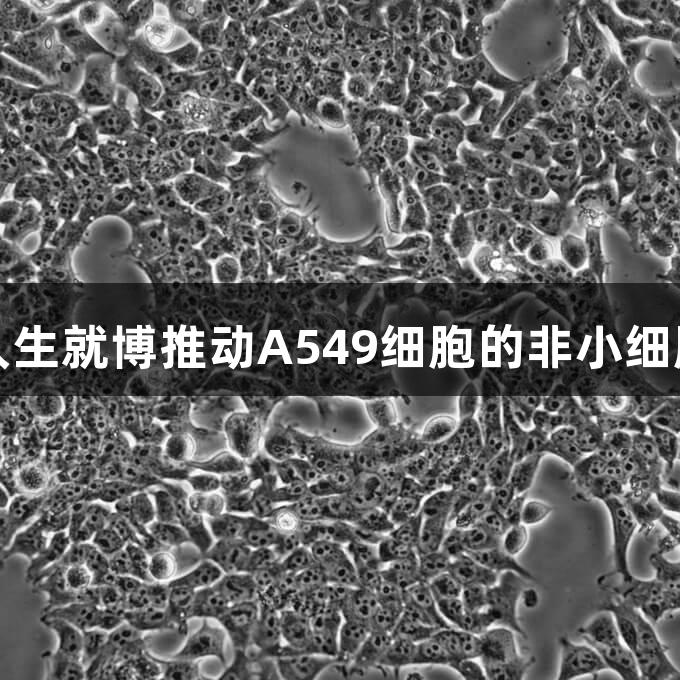 尊龙凯时人生就博推动A549细胞的非小细胞肺癌研究