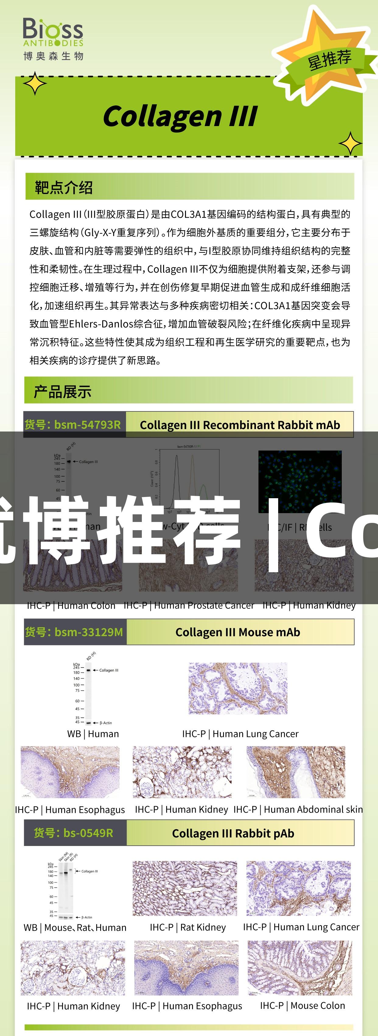 尊龙凯时人生就博推荐 | Collagen III 抗体
