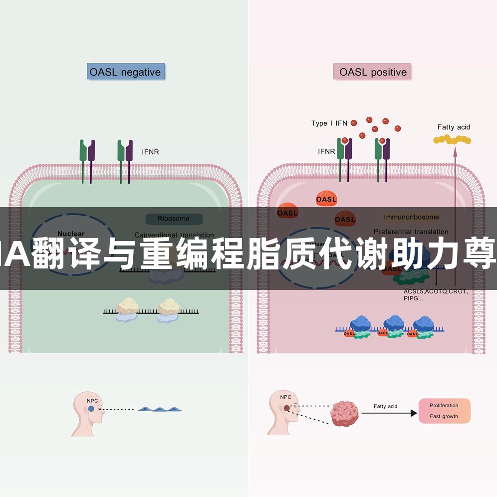 OASL通过增强mRNA翻译与重编程脂质代谢助力尊龙凯时癌症研究进展