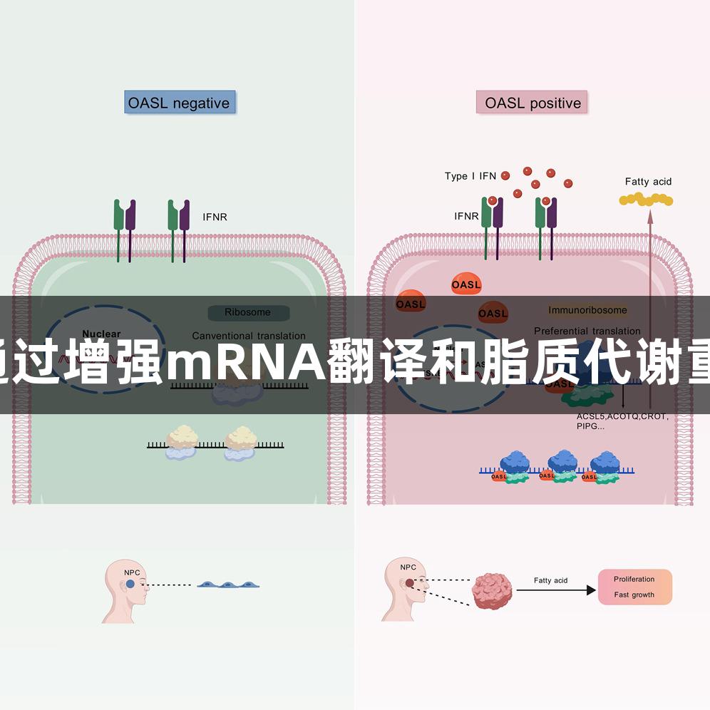 尊龙凯时：OASL通过增强mRNA翻译和脂质代谢重编程促进癌症发展