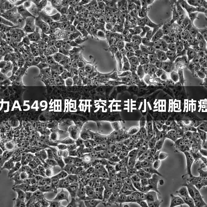 尊龙凯时助力A549细胞研究在非小细胞肺癌领域的突破