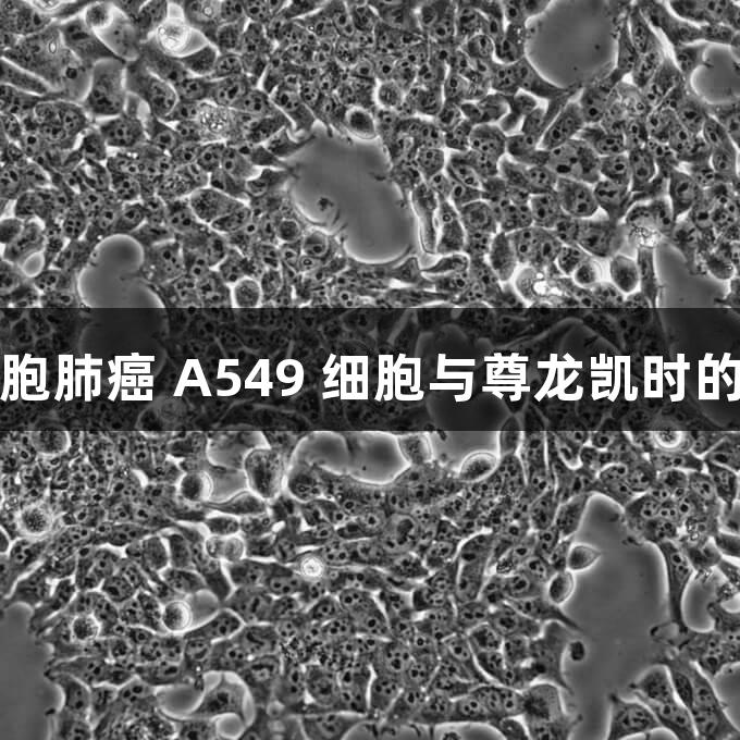 人非小细胞肺癌 A549 细胞与尊龙凯时的研究进展