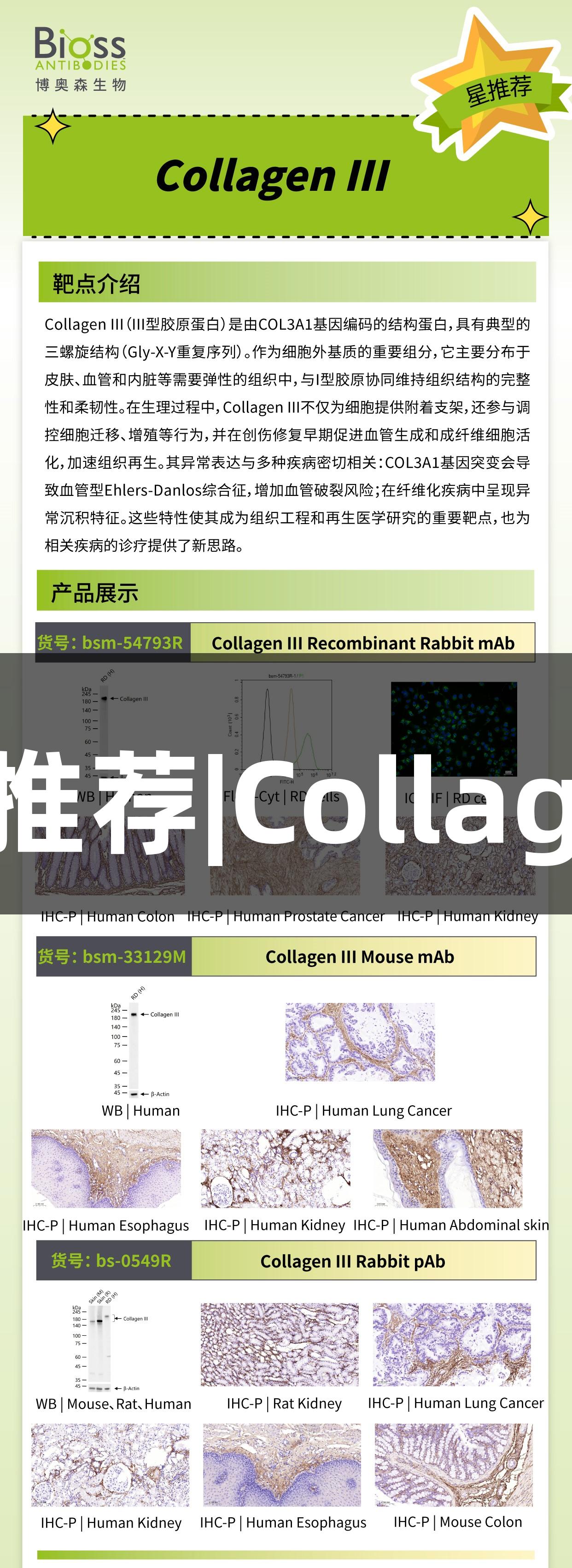 尊龙凯时推荐|CollagenIII抗体