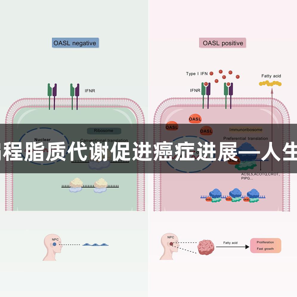 OASL通过增强mRNA翻译和重编程脂质代谢促进癌症进展—人生就是博-尊龙凯时的生物医疗探索