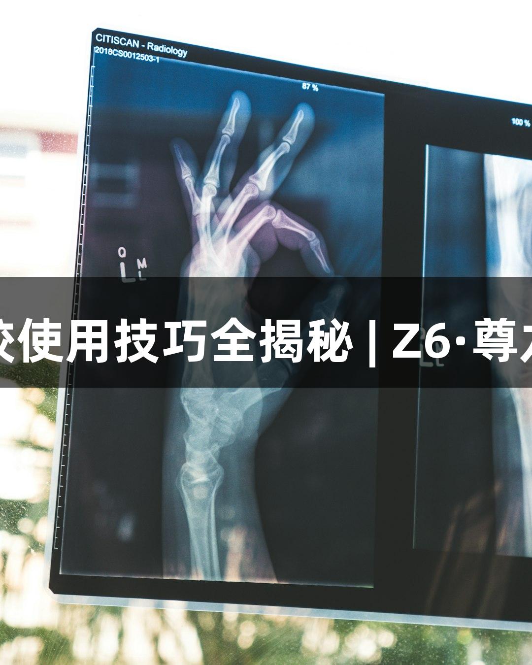 基质胶使用技巧全揭秘 | Z6·尊龙凯时