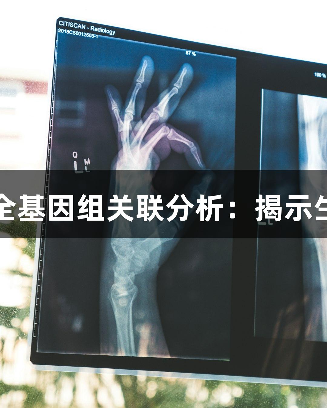 探秘尊龙凯时全基因组关联分析：揭示生物医疗新视野