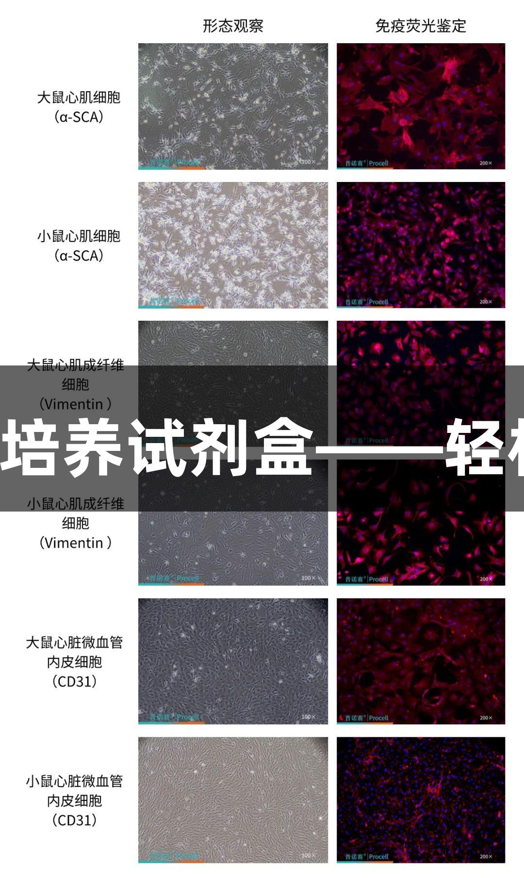 尊龙凯时心脏类原代细胞分离培养试剂盒——轻松获取高纯度心肌及相关细胞！