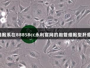HCCC-9810细胞系在88858cc永利官网的胆管细胞型肝癌研究中的应用