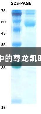 佛山基孔肯雅热疫情中的尊龙凯时检测突破与疫苗希望