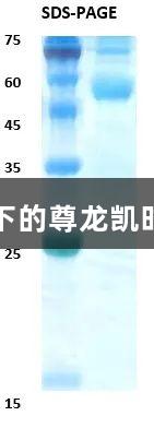佛山基孔肯雅热疫情下的尊龙凯时检测突破与疫苗希望