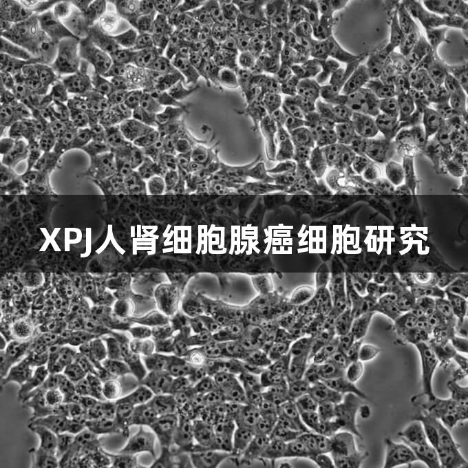 XPJ人肾细胞腺癌细胞研究