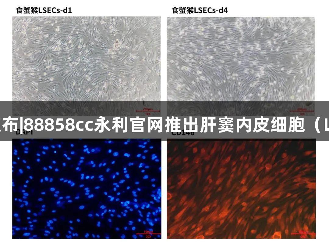 新品发布|88858cc永利官网推出肝窦内皮细胞（LSECs）