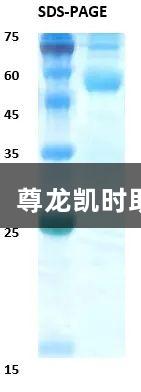 佛山基孔肯雅热疫情下，尊龙凯时助力检测突破与疫苗希望