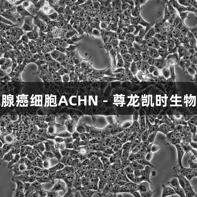 人肾细胞腺癌细胞ACHN - 尊龙凯时生物医疗研究