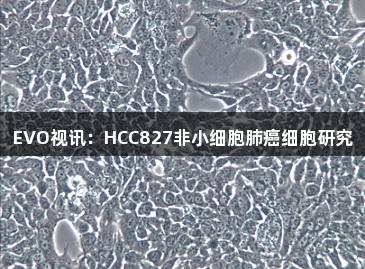 EVO视讯：HCC827非小细胞肺癌细胞研究