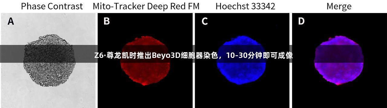 Z6·尊龙凯时推出Beyo3D细胞器染色，10-30分钟即可成像