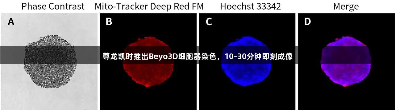 尊龙凯时推出Beyo3D细胞器染色，10-30分钟即刻成像