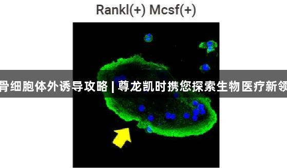破骨细胞体外诱导攻略 | 尊龙凯时携您探索生物医疗新领域