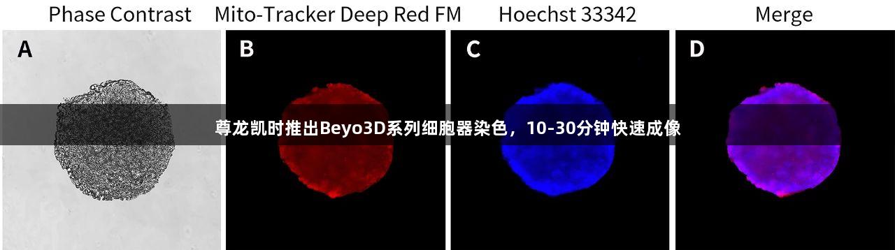 尊龙凯时推出Beyo3D系列细胞器染色，10-30分钟快速成像