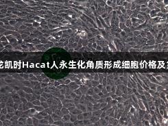 尊龙凯时Hacat人永生化角质形成细胞价格及货期